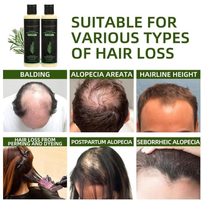 🌱 Organic Rosemary Hair Growth Shampoo